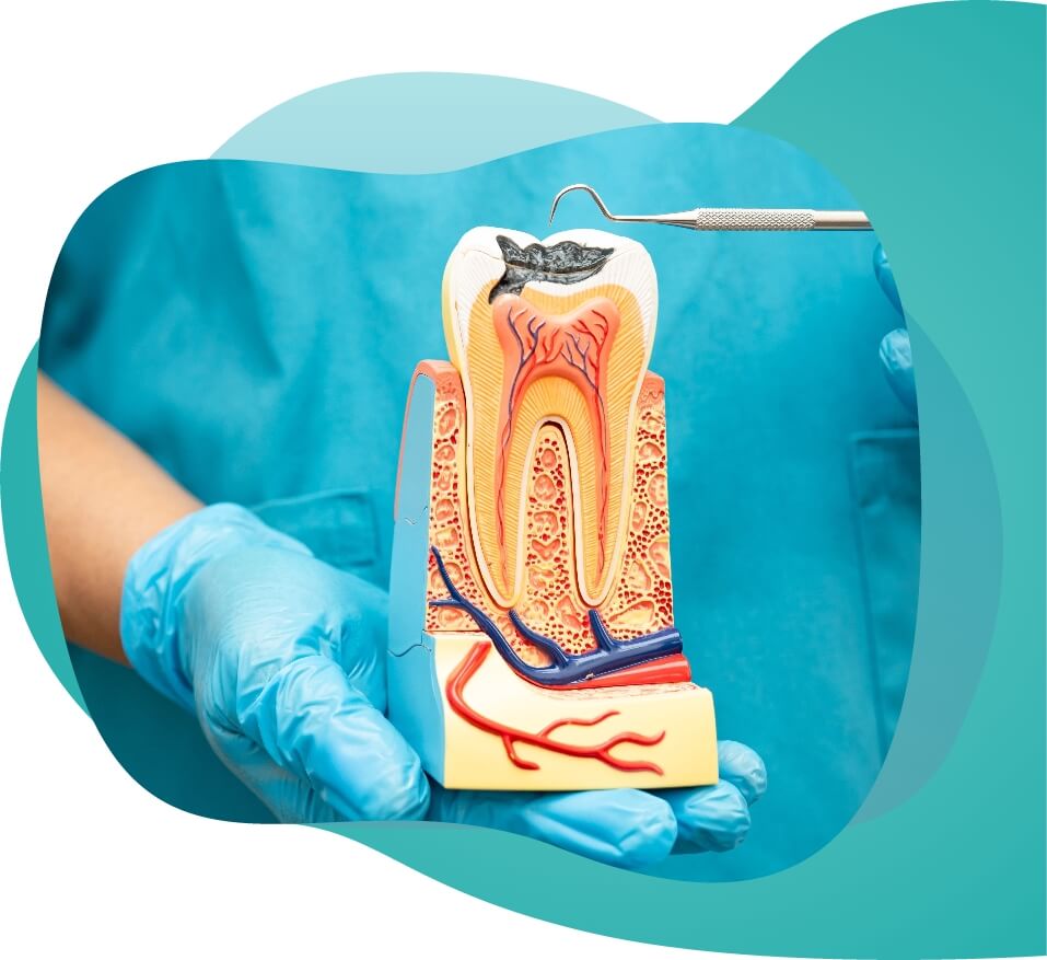 Canal therapy right image