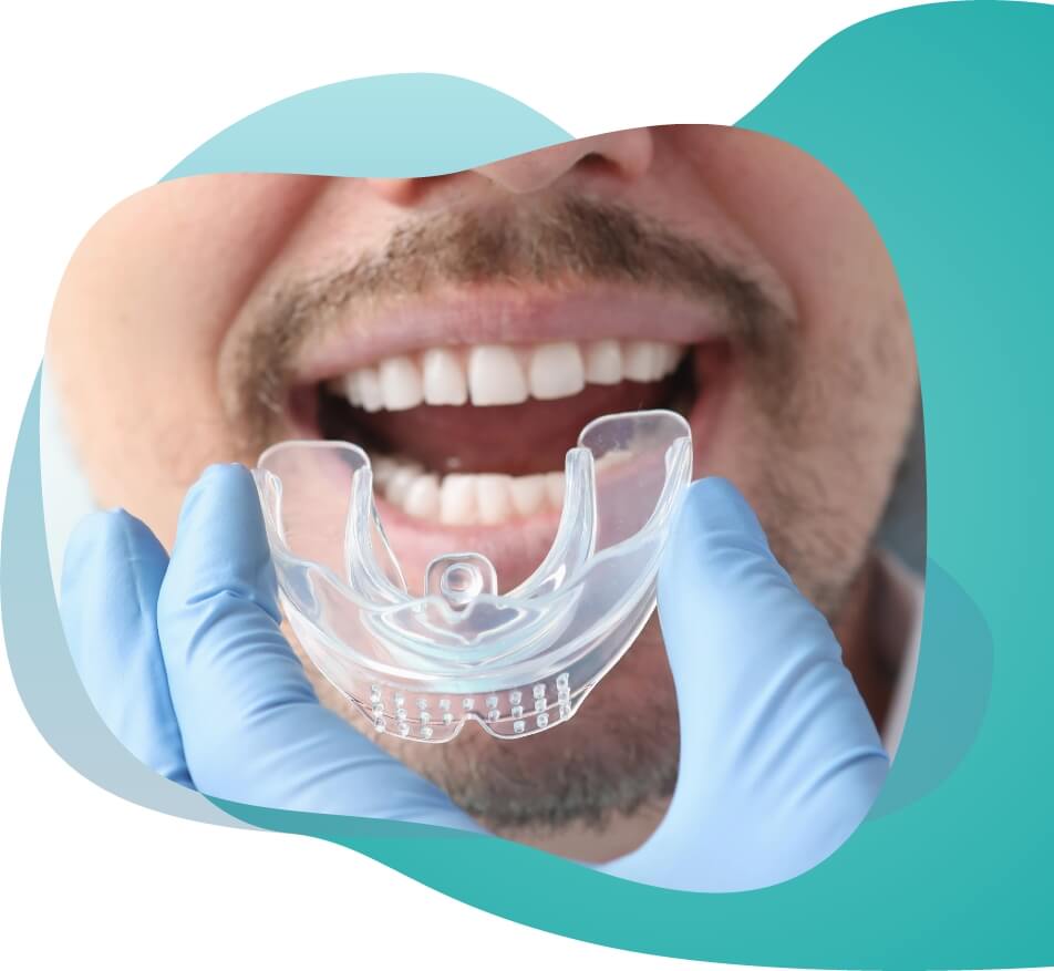 Night guard right image