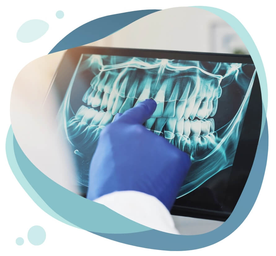 Quality restoration image