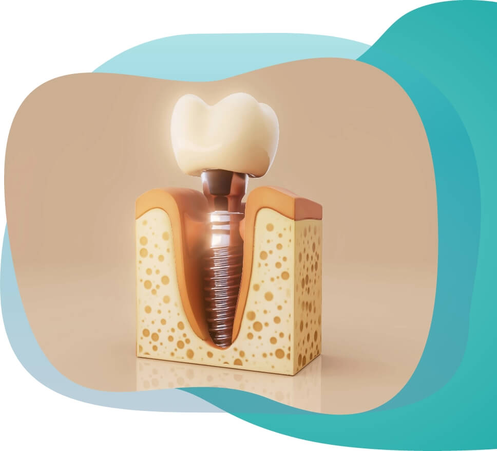 Right dental for image