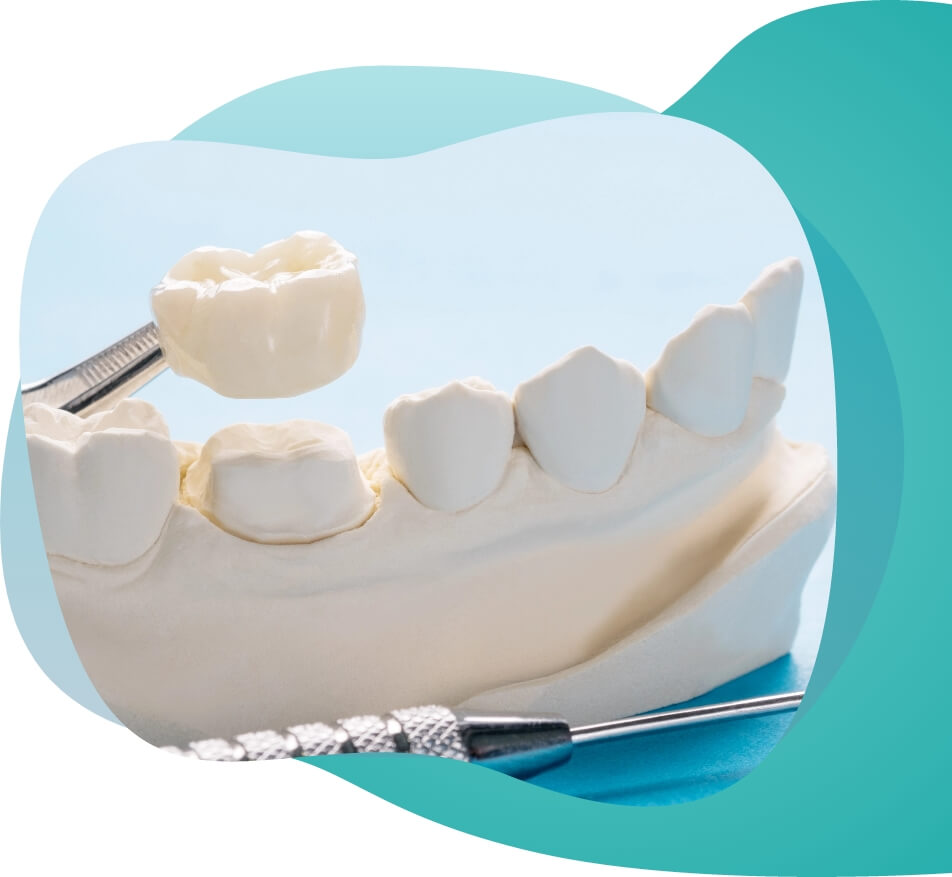 Tooth protection image