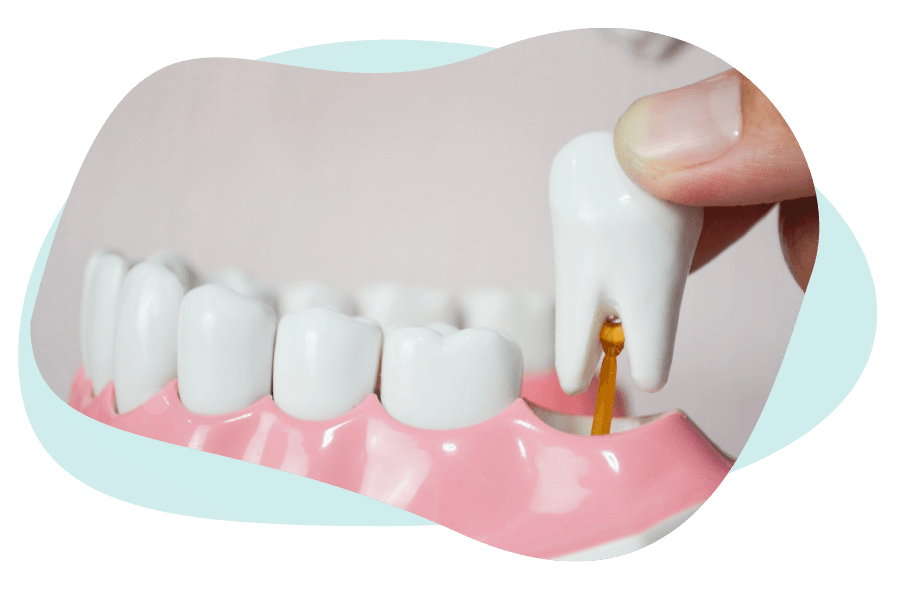 Wisdom teeth banner image